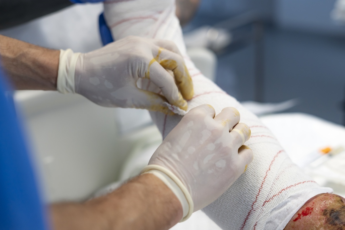 Curativo para Feridas em Casa